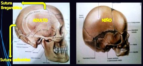 Esquema comparativo cráneo bebé vs adulto