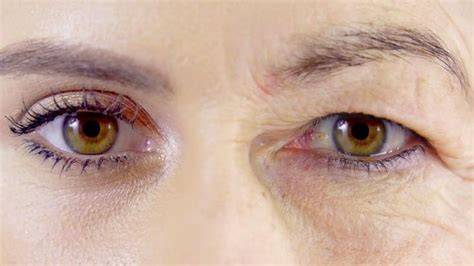 Detalles: ojos envejecidos y párpados caídos