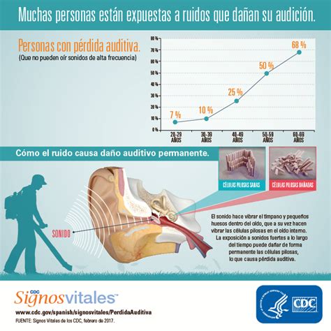 Infografía: Estadísticas globales de pérdida auditiva y proyecciones futuras