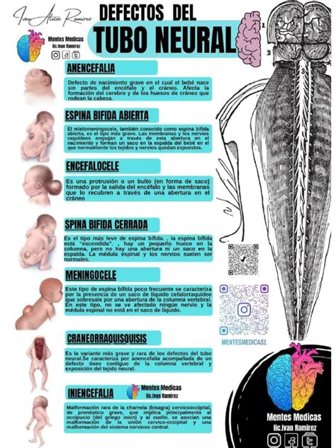 Esquema de defectos del tubo neural (espina bífida, anencefalia) y representación del síndrome de Down