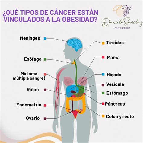 Infografía: Cánceres asociados con niveles elevados de AFP