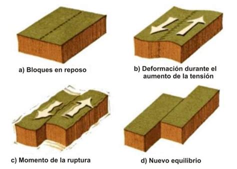 Esquema de los diferentes tipos de temblores (en reposo, postural, cinético e intencional)