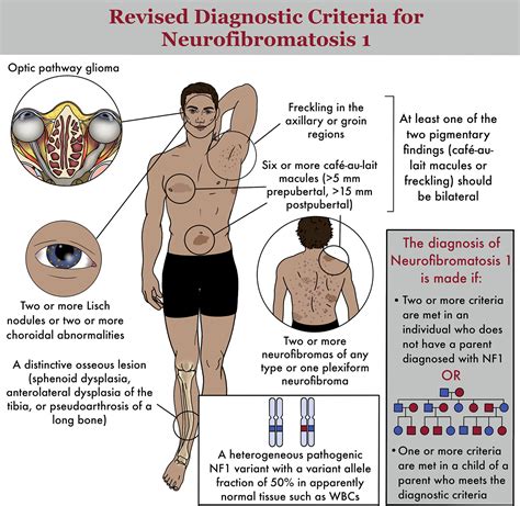 Fig. 1. Neurofibromatosis y otras neurocutáneas como posibles etiologías del RPM