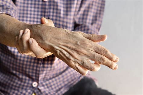 Foto de piernas de un adulto mayor mostrando signos de atrofia muscular