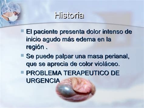 Foto de hemorroides trombosadas