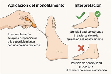 Ilustración de un adulto mayor realizando una prueba de sensibilidad táctil en los pies con un monofilamento.