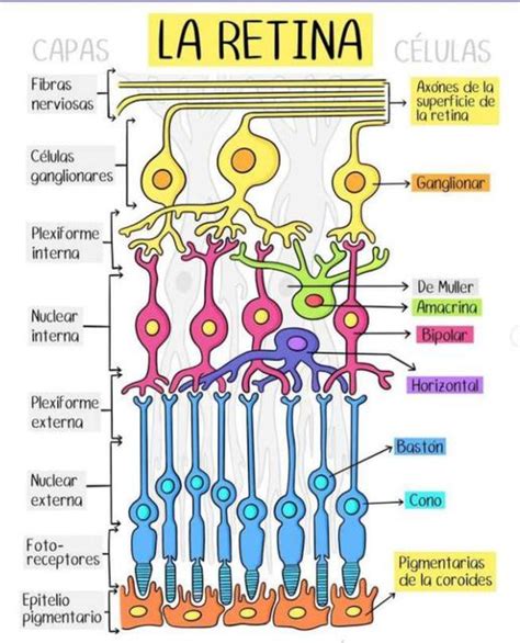 Representación gráfica del desprendimiento de retina, mostrando la separación de las capas retinianas.