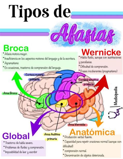 Infografía sobre las áreas del cerebro afectadas por la afasia y sus funciones lingüísticas
