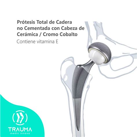 Infografía sobre los distintos materiales de las prótesis de cadera (metal, polietileno, cerámica)