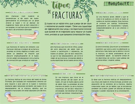 Esquema de los huesos del tobillo y tipos de fracturas