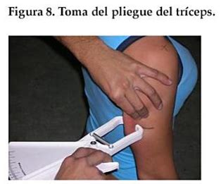 Ilustración de la técnica de medición del pliegue cutáneo tricipital