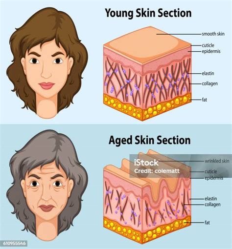 Ilustración comparativa de piel joven y envejecida