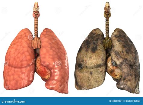Esquema de pulmones sanos vs. pulmones envejecidos o con fibrosis
