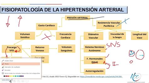 Esquema de la fisiopatología de la hipertensión sistólica aislada en el anciano, incluyendo rigidez arterial y disfunción endotelial.