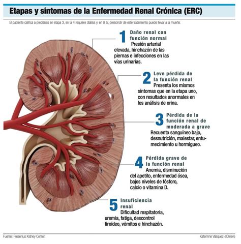 Esquema de las funciones renales y cómo se ven afectadas por la enfermedad renal crónica