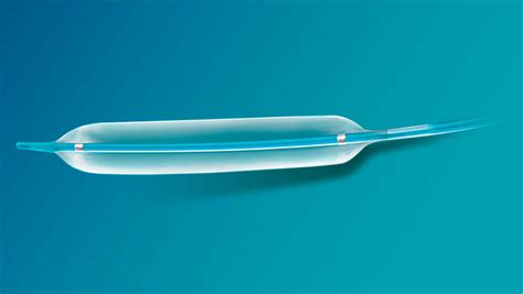 Esquema de estenosis uretral y métodos de dilatación o colocación de stent