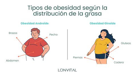 Ilustración comparando la distribución de grasa en la obesidad tipo manzana y tipo pera.