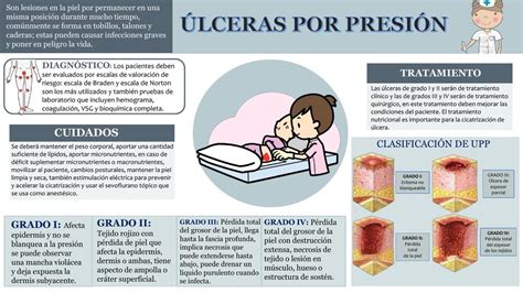 Infografía sobre las causas y prevención de úlceras por decúbito en ancianos