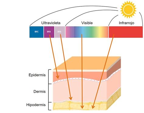 Diagrama mostrando la hiperpigmentación causada por la exposición UV en la piel