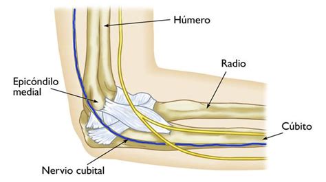 Infografía: Anatomía del nervio cubital y puntos de compresión en el codo