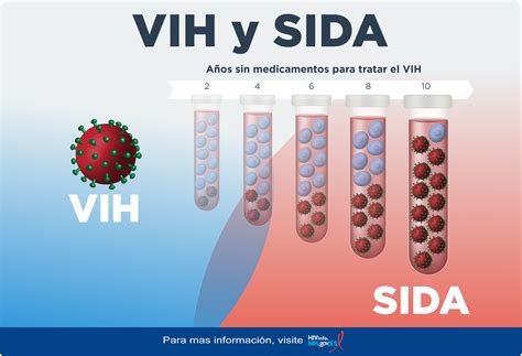 Esquema sobre la progresión del VIH a SIDA y sus efectos en el sistema inmunológico