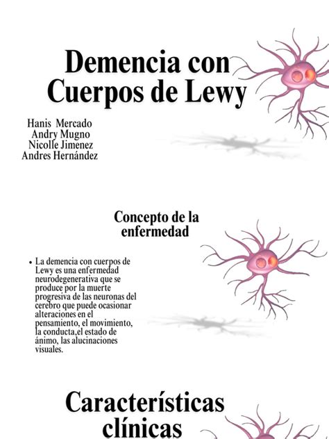 Ilustración de las neuronas dopaminérgicas y los cuerpos de Lewy