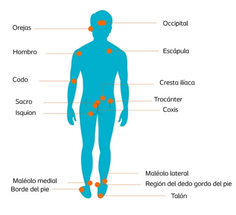 Esquema de las zonas de riesgo corporal para la aparición de úlceras por presión: sacro, talones, codos y caderas.