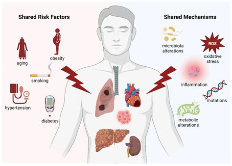 Diagrama que ilustra los factores multifactoriales que contribuyen a la desnutrición en pacientes paliativos, incluyendo enfermedad, síntomas, tratamiento y aspectos psicosociales.