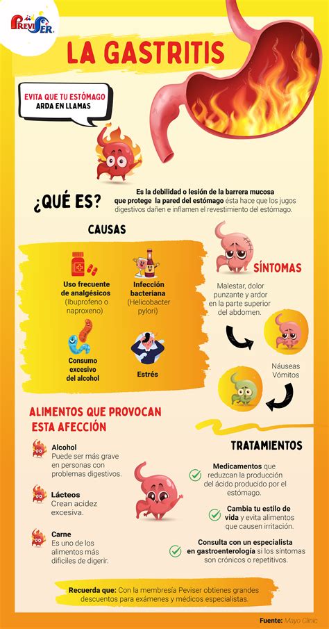 Infografía de los síntomas más comunes de la gastritis