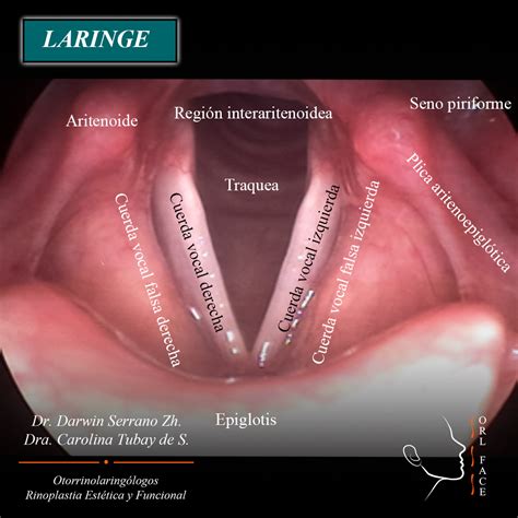 Imagen de una fibrolaringoscopia mostrando cuerdas vocales afectadas por presbifonía