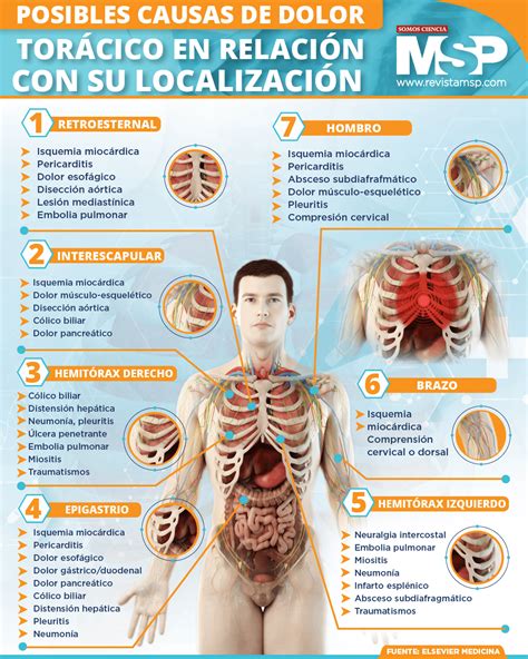 Infografía sobre las principales causas cardíacas de dolor torácico