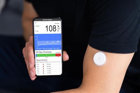 Foto de un monitor continuo de glucosa (CGM)