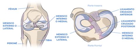 esquema comparativo de rodilla normal con meniscos y rodilla sin meniscos con aumento de presión