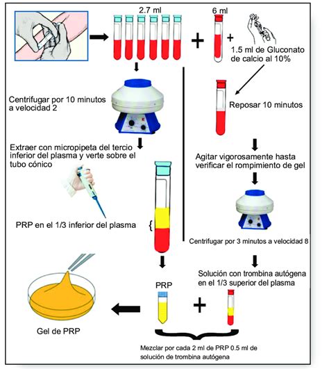 infografía sobre el proceso de obtención y aplicación de PRP en la rodilla