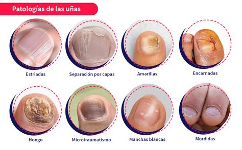 Foto: Cambios comunes en la piel y las uñas de adultos mayores