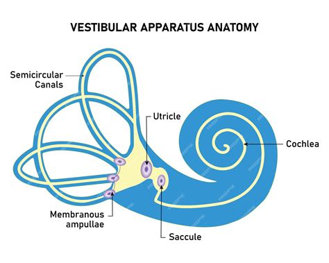 Diagrama: Mecanismo del VPPB con otoconias en los canales semicirculares