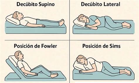 Esquema de las diferentes posturas para cambios posturales en pacientes encamados