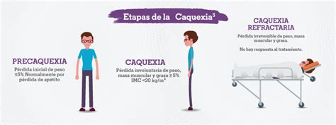 Gráfico mostrando la progresión de la caquexia en pacientes terminales