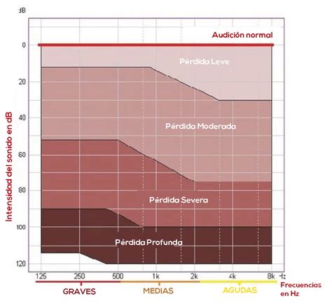 Gráfico de proyección global de pérdida de audición y déficit de rehabilitación