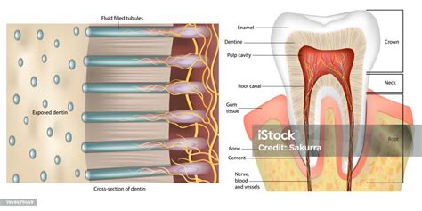 Esquema de la estructura de los túbulos dentinarios, mostrando la dentina peritubular e intertubular y la prolongación odontoblástica.