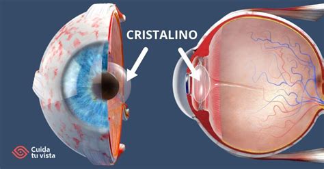 diagrama del ojo humano mostrando el cristalino y la retina