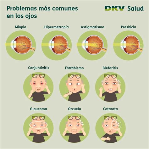 ilustraciones de las diferentes afecciones oculares comunes en adultos mayores