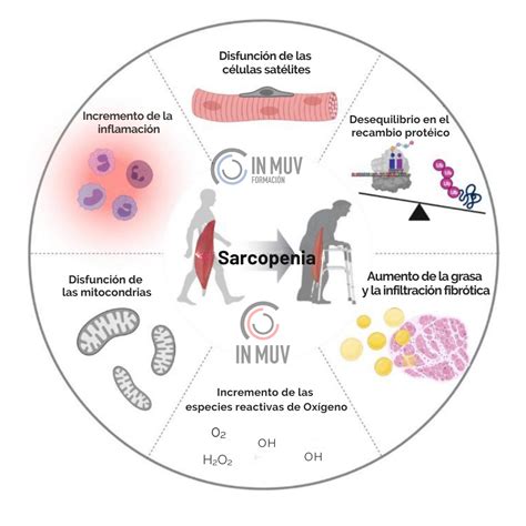 Esquema de la pérdida muscular por sarcopenia y su impacto