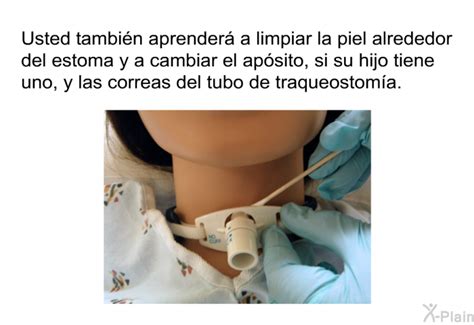 Enfermera realizando la limpieza del estoma de una traqueostomía en un paciente