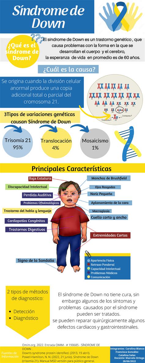 Imagen que ilustra la diversidad de rasgos del síndrome de Down y su variabilidad