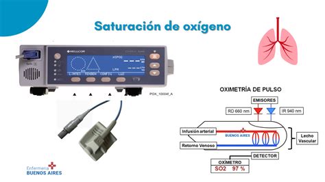 Esquema de la medición de saturación de oxígeno con un oxímetro de pulso en el dedo.