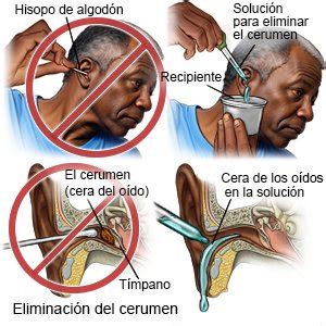 Foto de primeros planos de cerumen en el oído de una persona