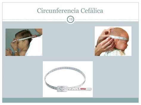 Gráfico de percentiles de circunferencia cefálica para diagnóstico de microcefalia