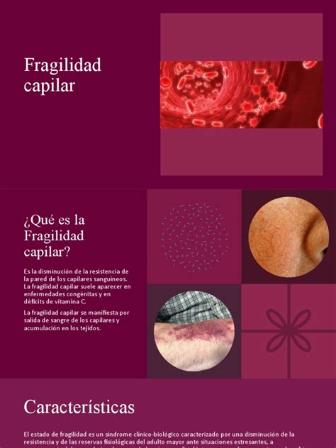 Infografía sobre las causas de la fragilidad capilar en el cabello