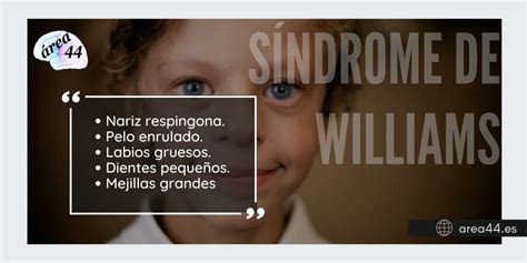 Esquema de las principales características del Síndrome de Williams
